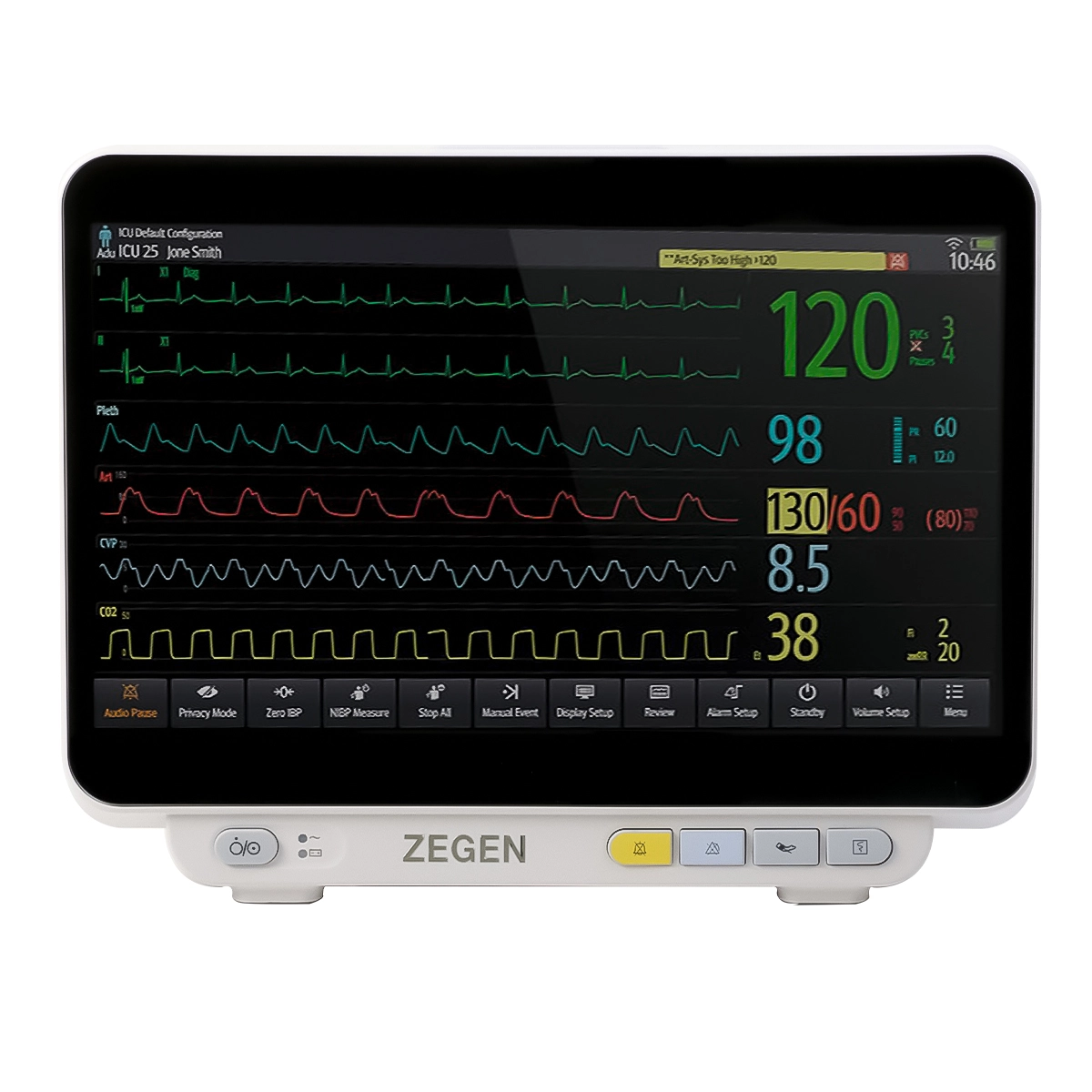 Monitor de signos vitales para hospitalización