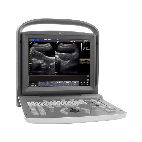 Vista frontal del ultrasonido doppler Chison ECO2 mostrando interfaz en pantalla