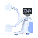 Imagen del Arco en C de alta frecuencia SLA-6C de uso quirúrgico