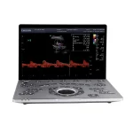 Vista general del ultrasonido portátil Sonoair-60 con diseño ligero y moderno