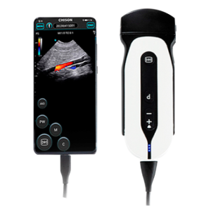 Ultrasonido portátil de mano SONOEYE-P5