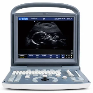 Ultrasonido Portátil de Alta Precisión ECO 2+